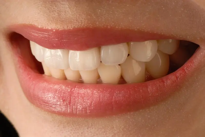 profilaxia dental