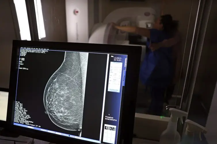 mamografia-de-rastreio-1 Entidades médicas pedem faixa etária maior para mamografia de rastreio
